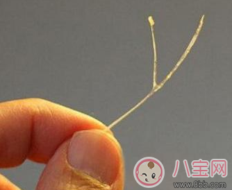 宝宝|宝宝吃鱼卡鱼刺 急着自己去夹刺就大错特错了