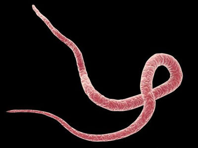 怎么知道肚子里有没有蛔虫？体内是否有蛔虫的判断方法