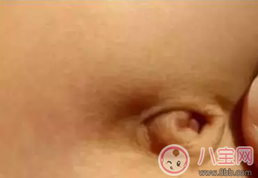 肚脐|孩子肚脐脏了怎么办 就算你有强迫症也不能抠