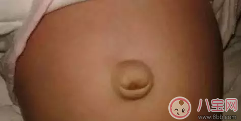 肚脐|孩子肚脐脏了怎么办 就算你有强迫症也不能抠