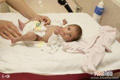 早产儿护理需尽心，父母应注意哪些要点呢>>儿童护理