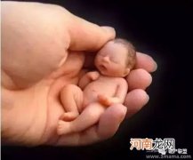 产妇早产的常见7大原因解析