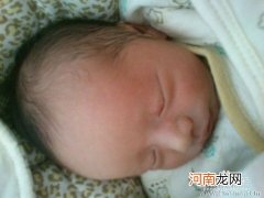 我的孩子是7月12出生的在第三天的时候开始出现黄疸