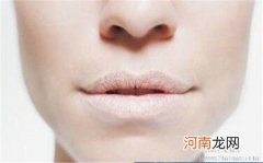 小儿慢性唇炎的防治办法