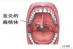 扁桃体：该爱你还是恨你