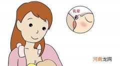 早孕和月经前兆有哪些区别 怀孕初期症状月经的感觉