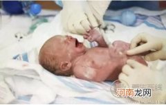 教你怎么护理早产儿