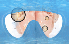 治疗小儿夏季热的6个足浴方