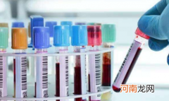 正常人群里艾滋病多吗