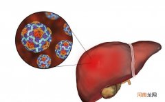 肝炎的传染性强 预防肝炎应该怎么做