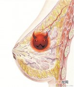 甲状腺出现肿块应尽早就医