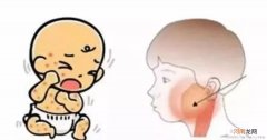 帮助宝宝走出腮腺炎的痛苦