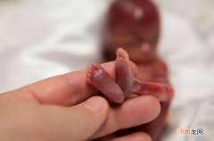 孕妈怎么预防早产呢 怎样科学地看待早产呢