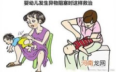 意外伤害急救处理：异物吸入
