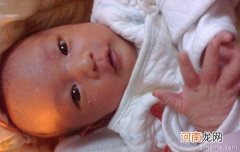 新生儿总蜕皮用看医生吗？