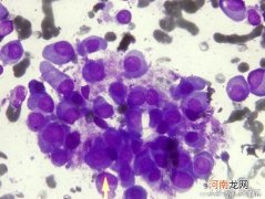 治疗带状疱疹的药物与用法