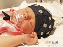 治疗宝宝便秘的实用小窍门