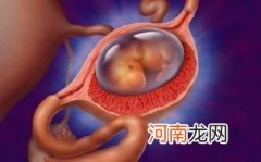 宫外孕手术后可以怀孕吗优质