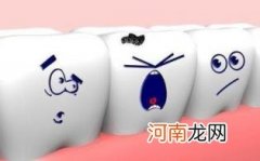 磨牙有哪些症状优质