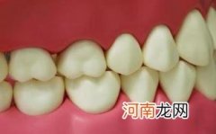 晚餐吃得过饱会磨牙优质