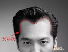 发际线高和智商有关吗 为什么智商高的人发际线高