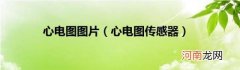 心电图传感器 心电图图片