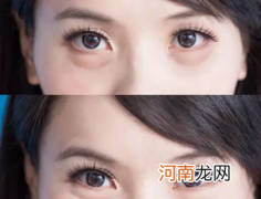 眼膜怎么用才正确方法 眼膜哪个牌子好用可以推荐一下