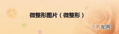 微整形 微整形图片