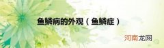 鱼鳞症 鱼鳞病的外观