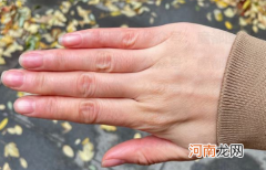 手冻僵了能用热水泡吗