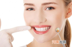 拔牙用的棉球可以去药店买到吗