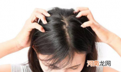 脱发和脾胃有关吗