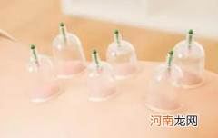 拔罐减肥有没有效果
