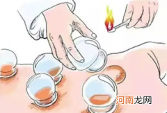 拔罐的好处和坏处多久拔一回