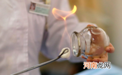 拔罐后多长时间可以洗澡