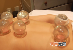 拔罐的好处与功效