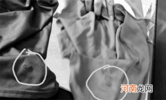 老鼠尿污染衣物清洗方法 老鼠尿味怎么去除