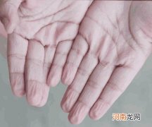 为什么洗澡后手指会长皱纹，这是正常现象吗？