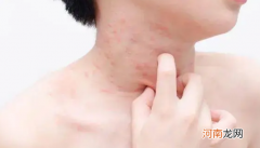 人会过敏的原因 人为什么会过敏