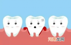 牙齿松动的原因 牙齿为什么会松动