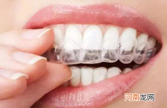 矫正牙齿的好处 为什么要矫正牙齿