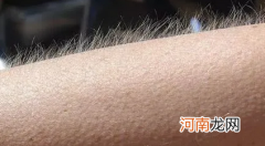 人体生理常识科普 遇冷为什么会起鸡皮疙瘩