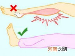 腿抽筋怎么办 双腿抽筋是什么原因双腿抽筋怎么办