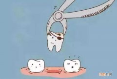 龋齿怎么办 儿童智齿龋齿怎么办