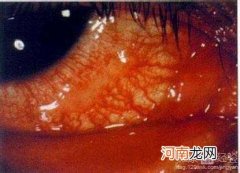 结膜炎怎么办 猫咪结膜炎怎么办