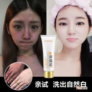 晒黑如何变白 皮肤晒黑如何变白