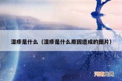 湿疹是什么原因造成的图片 湿疹是什么