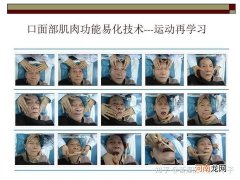 面瘫如何治疗 得了面瘫用什么方法治疗最有效