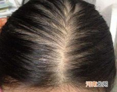 怎么去头油 照片怎么去头油