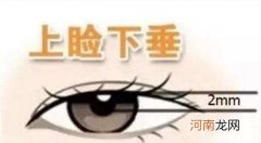 睑怎么读 上眼睑怎么读